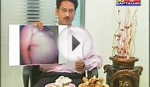 Central obesity Ayurveda Treatment Dr.T.Venugopal rao M.D